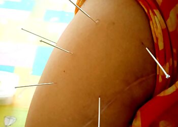 Bone N joint Physiotherapy Advance In neuro Rehabilitation