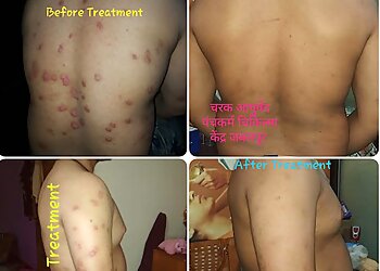 Charak Ayurveda & Panchkarma Chikitsa Kendra