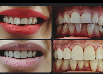 Clove Dental Jalandhar