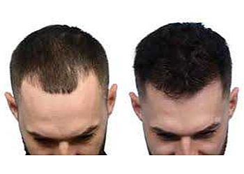 DR. Akhilendra Singh, MBBS, MD - AKS CLINIC