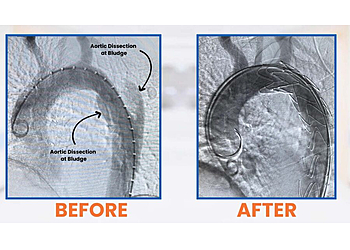 DR. HEMANT CHAUDHARI -MBBS, DNB -Manipal Hospital, Kharadi - Pune