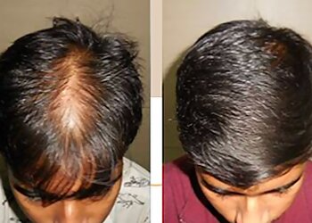 Dr. Aditi Garg, MBBS, MD - DR. ADITI'S SKIN CLINIC