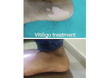 Dr. Amol Nagargoje, MBBS, DDVL - SUREKH SKIN, HAIR, LASER & DENTAL CLINIC