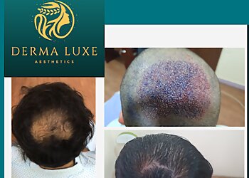 Dr. Ariganesh Chandrasegaran, MBBS, MD - DERMA LUXE AESTHETICS