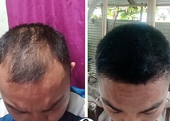 Dr. Atul Bothra, MBBS, MD, FRGUHS - SKIN SQUARE CLINIC