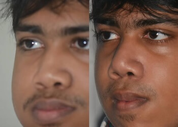 Dr. Chetan Dhandore, MBBS, MS, M.Ch - DHANDORE HOSPITAL