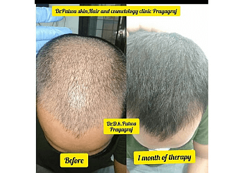 Dr. D.K Patwa, MBBS, MD - DR. PATWA SKIN CARE & HAIR CLINIC