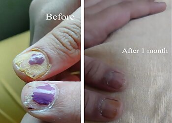 Dr. Esther Nimisha, MBBS, MD