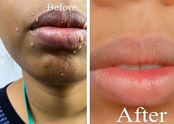 Dr. Esther Nimisha, MBBS, MD