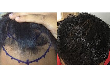 Dr. Gagandeep Singh Thind, MBBS, MS, M.Ch - DIVINE AESTHETICS & LASER CLINIC