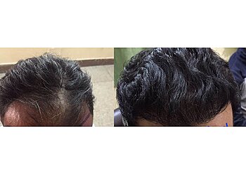 Dr. Gagandeep Singh Thind, MBBS, MS, M.Ch - DIVINE AESTHETICS & LASER CLINIC