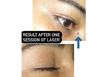 Dr. Garima Singh, MBBS, MD - SKIN SAVVY CLINIC