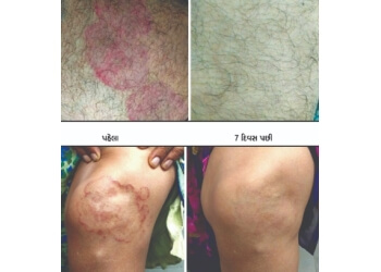 Dr. Hardik Savani, MBBS, DNB - SAVANI SKIN CLINIC