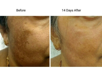 Dr. Hardik Savani, MBBS, DNB - SAVANI SKIN CLINIC