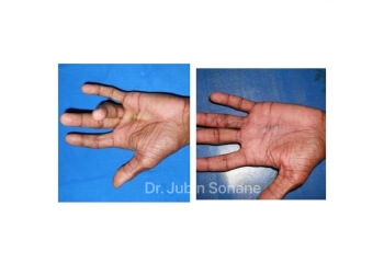 Dr. Jubin Sonane, MBBS, MS, M.Ch - DR. SONANE’S PLASTIC SURGERY CLINIC