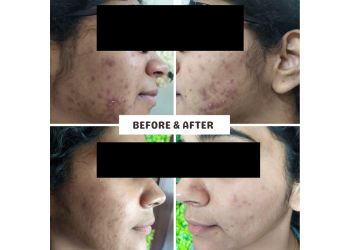 Dr. Kalyani Katkar, MBBS, MD - FLOURISH SKIN AND COSMETIC CLINIC