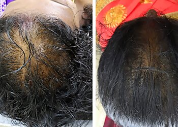 Dr. M. Rangaraj, MBBS, MD, DVL - VIGNESH SKIN & HAIR CLINIC