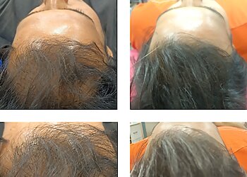 Dr. M. Rangaraj, MBBS, MD, DVL - VIGNESH SKIN & HAIR CLINIC