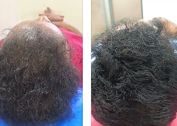 Dr. M. Rangaraj, MBBS, MD - VIGNESH SKIN & HAIR CLINIC