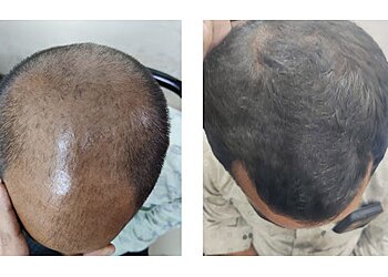 Dr. Naveen keswani, MBBS, DNB, FIAD - BRITE SKIN LASER & DENTAL CLINIC