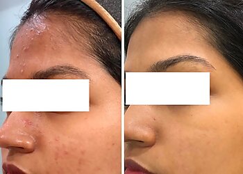 Dr. Nikita Patel, MBBS, DDVL, DNB - CLEAR SKIN CLINIC