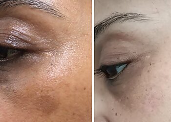 Dr. Nikita Patel, MBBS, DDVL, DNB - CLEAR SKIN CLINIC