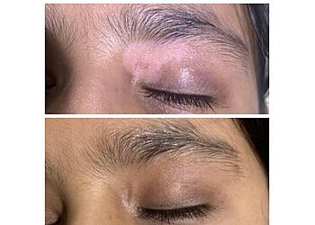 Dr. Nitin Mishra, MBBS, MD - CUTIZONE SKIN & LASER CLINIC
