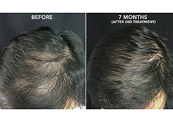 Dr. P.J. Mazumdar, MS, FICS - AROGYAM HAIR TRANSPLANT CLINIC
