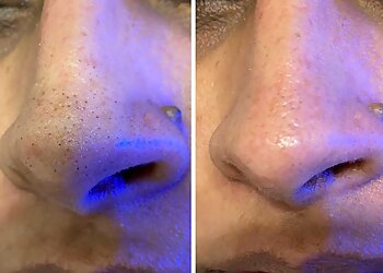 Dr. Piyusha Bhagde, MBBS, MD - SKIN ETHICS CLINIC