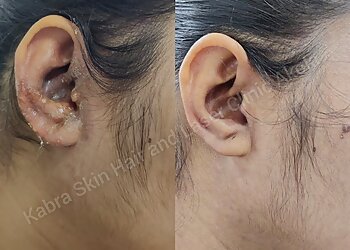Dr. Poonam Kabra, MBBS, MD - KABRA SKIN, HAIR AND LASER CLINIC
