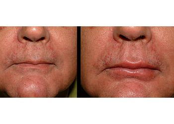 Dr. Rakesh Kalra MBBS, MS, M.Ch - ASHIRWAD HOSPITAL