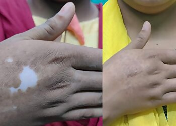 Dr. SK Masud Hassan, MBBS, MD