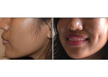 Dr. Sandeep Kansal, MBBS, MS, M.Ch - KAILASHI SUPER SPECIALITY