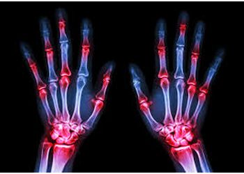 Dr. Silas S. Nelson, MBBS, MD