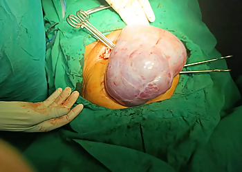 Dr. Sonal Richhariya, MBBS, DGO, DNB