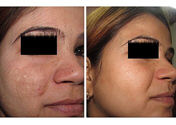 Dr. Sunil Trivedi, MBBS, DVD - TRIVEDI SKINCARE AND COSMETIC LASER CENTER