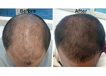 Dr. Tanveer Ahmed, MBBS, DDVL - ONESPINE NEXUS MEDICAL CENTRE