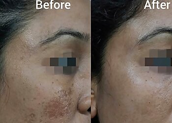 Dr. Twinkle Daulaguphu, MBBS, MD