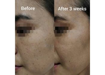 Dr. Twinkle Daulaguphu, MBBS, MD