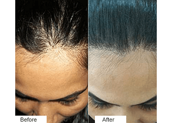 Dr. Vivek Mishra, MBBS, MD