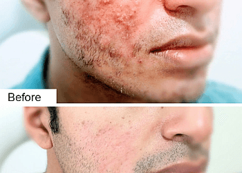 Dr. Vivek Mishra, MBBS, MD