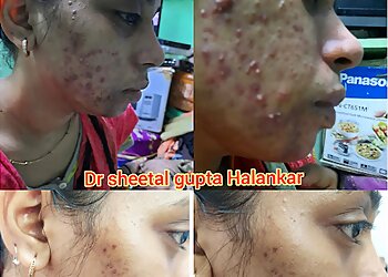 Dr sheetal gupta Halankar
