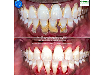 G-Dent Dental Clinic