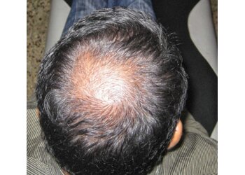 Kalyan Dombivli Hair Transplant Surgeons Glorious Skin & Hair Clinic image 1