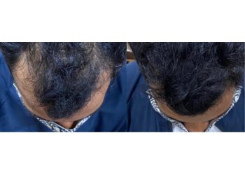 Pulse Skin & Hair Clinic