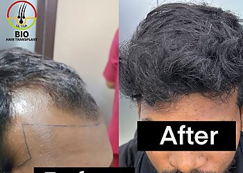 Ultra Bio Hair Transplant Clinic